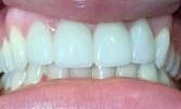 Trinity After Treatment