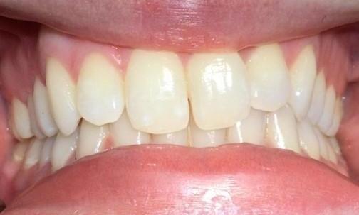 Trinity Before Treatment